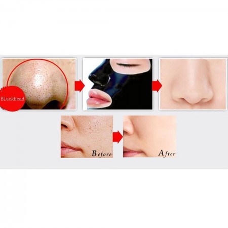 بلک ماسک زغالی پیلاتن (مسافرتی)