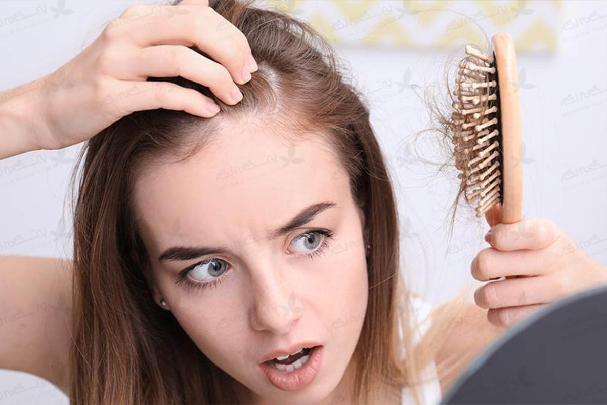 روش جلوگیری از ریزش مو بعد از زایمان